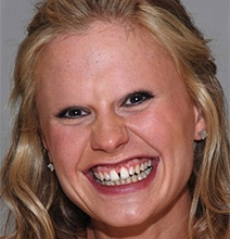 Celebrities-Without-Eyebrows-Images-Main.jpg