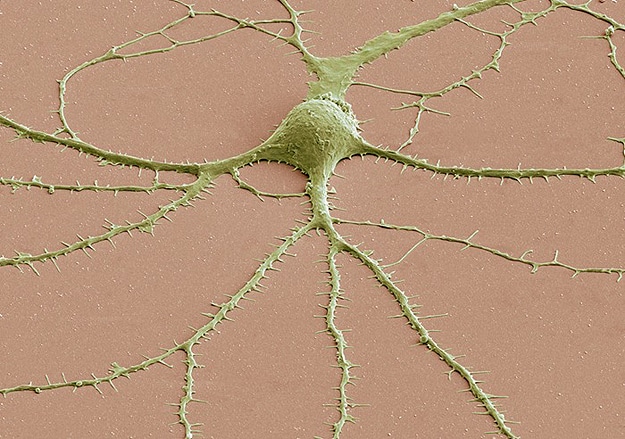 Geek Alert: Brain Cells Under A Microscope!