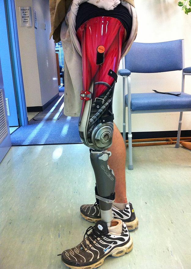 Social Media Saves The Day With A Terminator Leg Social Media Saves The Day With A Terminator Leg