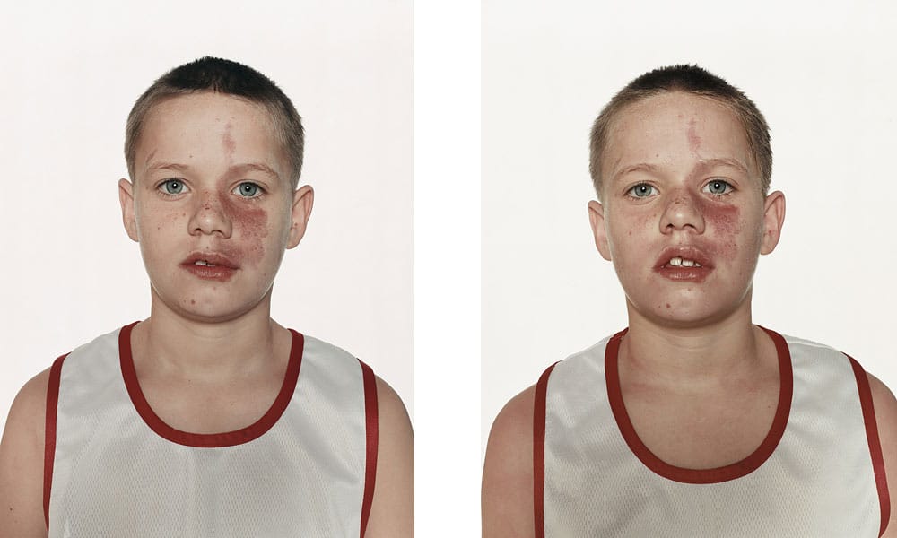 Boxers: Before & After The Fight Boxers: Before & After The Fight