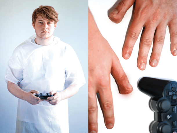 Gaming Injuries: It’s A Dangerous Business Gaming Injuries: It’s A Dangerous Business