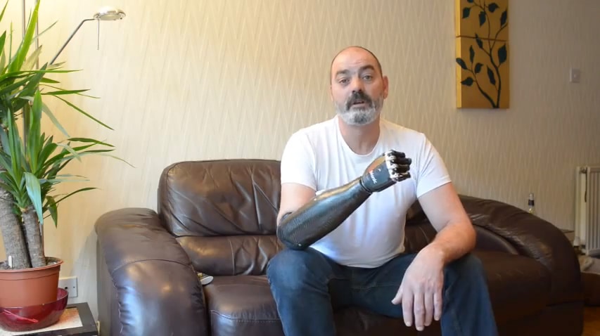 Prosthetic Arm Just Made Luke Skywalker Technology A Reality Prosthetic Arm Just Made Luke Skywalker Technology A Reality