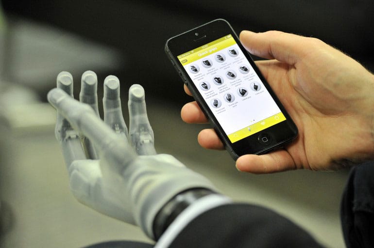 World’s First App-Controlled Prosthetic Hand Allows Natural Functions World’s First App-Controlled Prosthetic Hand Allows Natural Functions
