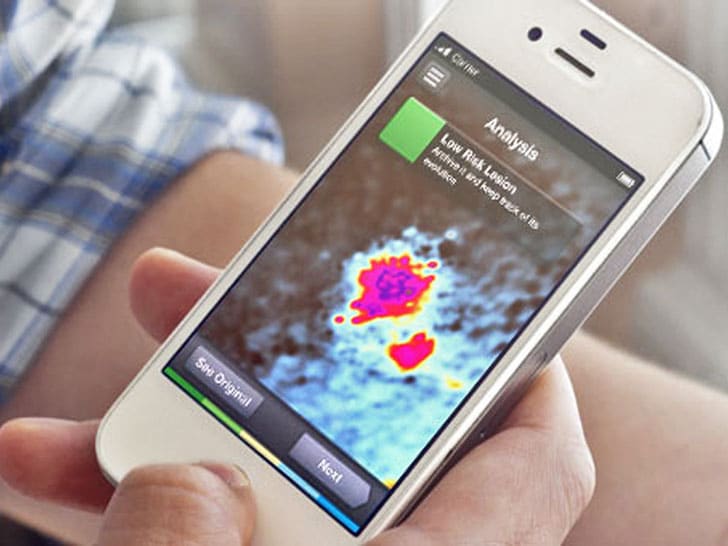SkinVision App Turns Your Smartphone Into A Skin Cancer Scanner SkinVision App Turns Your Smartphone Into A Skin Cancer Scanner