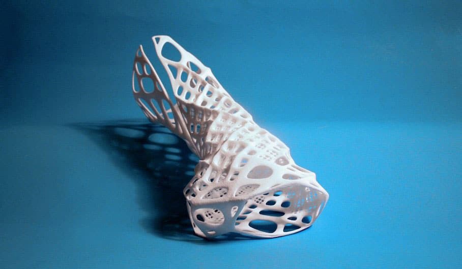 Custom 3D Printed Wrist Splint Can Help People In Undeveloped Regions Custom 3D Printed Wrist Splint Can Help People In Undeveloped Regions