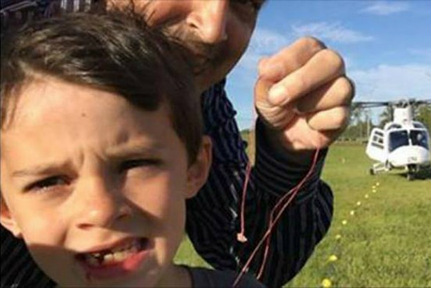 Dad Uses His Helicopter To Remove His Son’s Loose Tooth Dad Uses His Helicopter To Remove His Son’s Loose Tooth