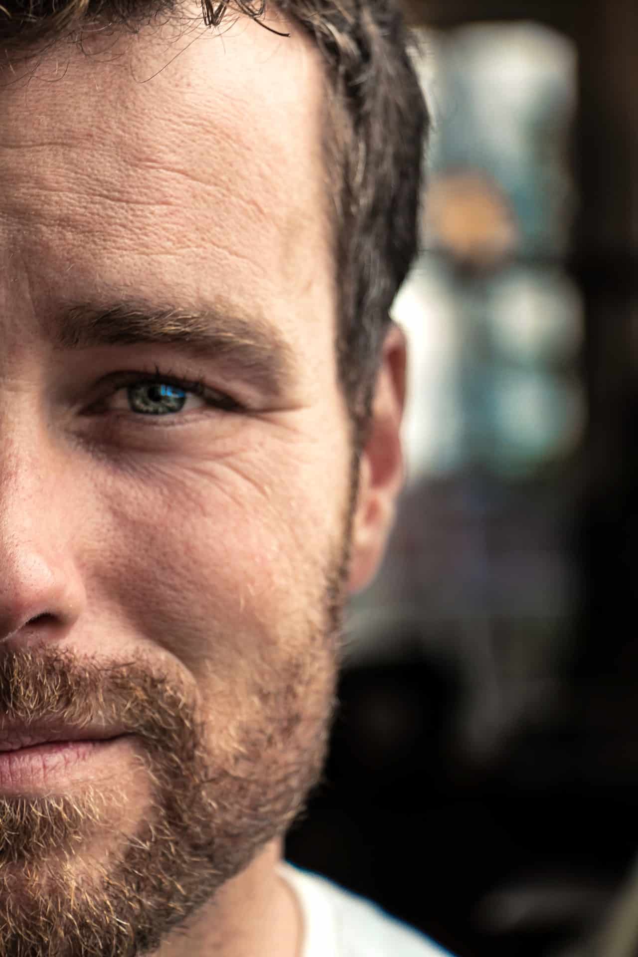 Hair Transplant Turkey Article Image