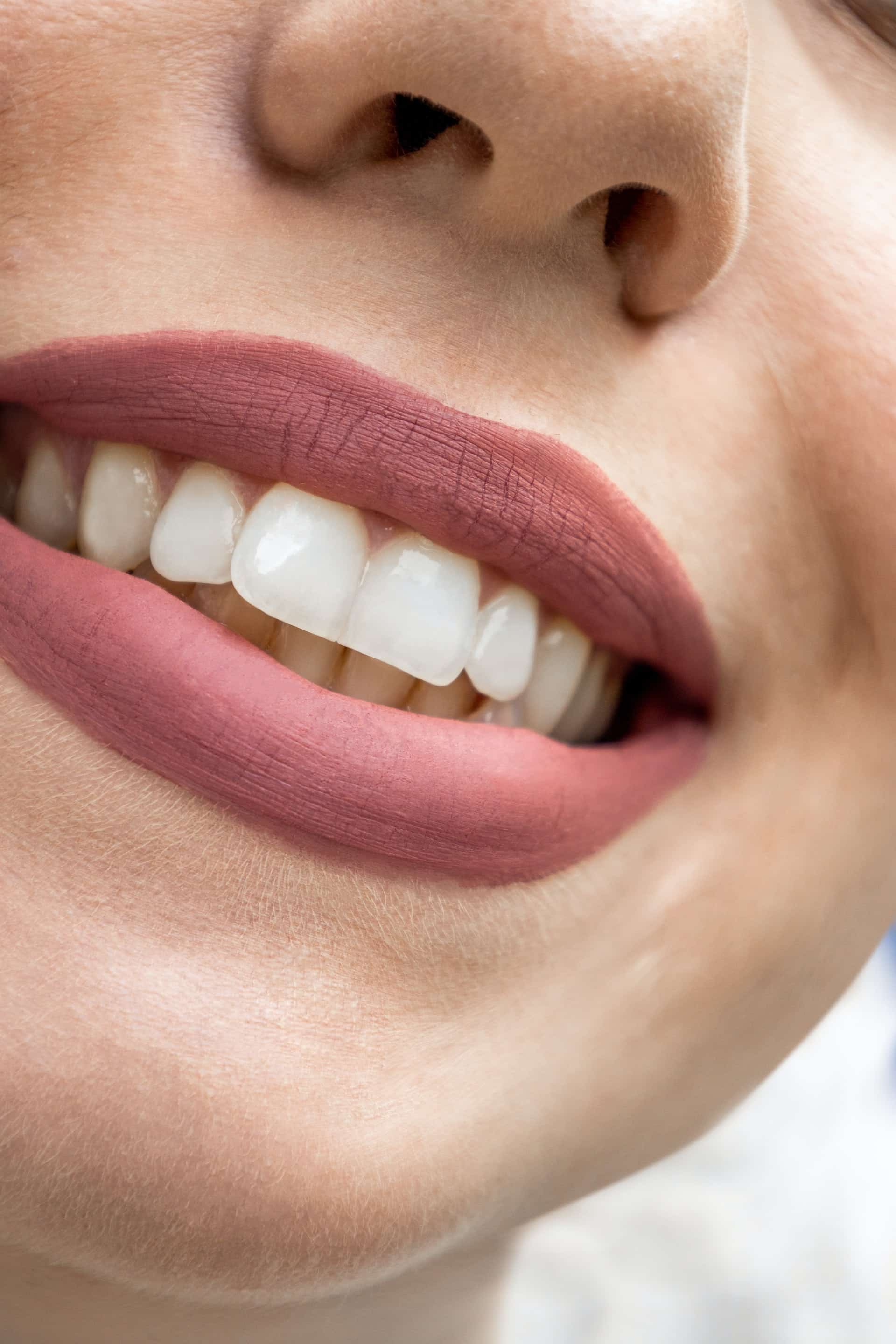 Reasons Porcelain Veneers Article Image