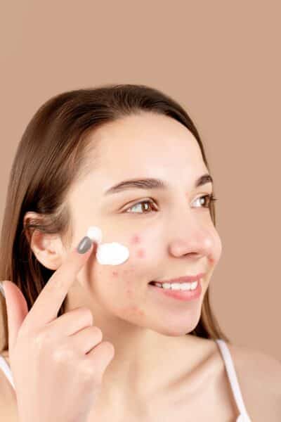 Acne Treatments For Adults Guide Image2
