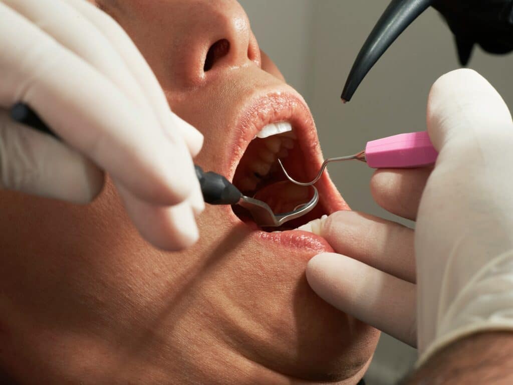 Gum Treatment: Nurturing Oral Health At Rochor Dental Clinics